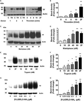 PAR2 Activation on Human Kidney Tubular Epithelial Cells Induces Tissue Factor Synthesis, That Enhances Blood Clotting